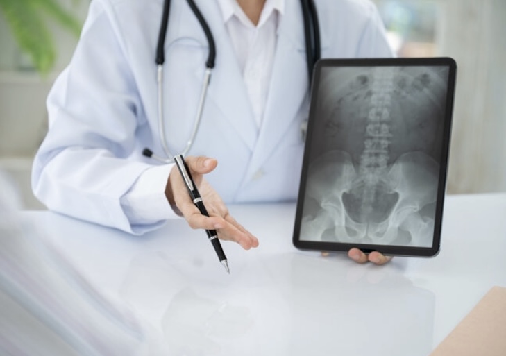 Espondilolistesis y escoliosis del adulto, Dr. Ortola, traumatólogo en Calpe