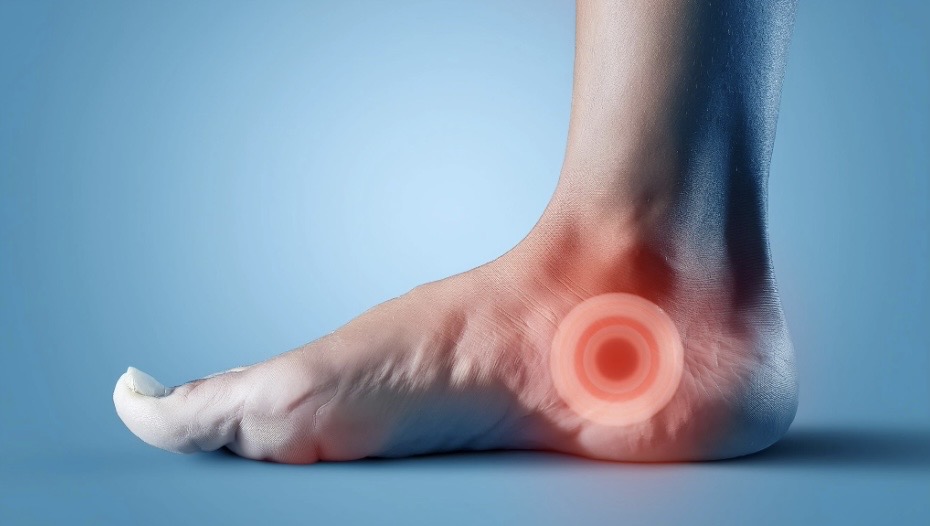 Tendinitis de Aquiles y peroneos, Dr. Ortola, traumatólogo en Calpe