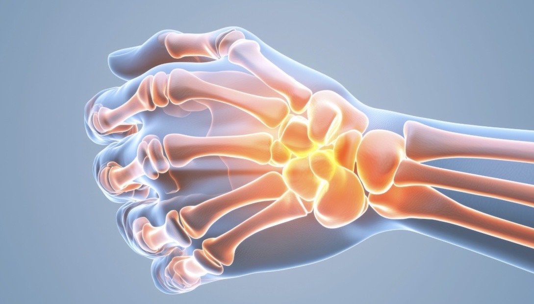 Tendinitis de De Quervain, Dr. Ortola, traumatólogo en Calpe